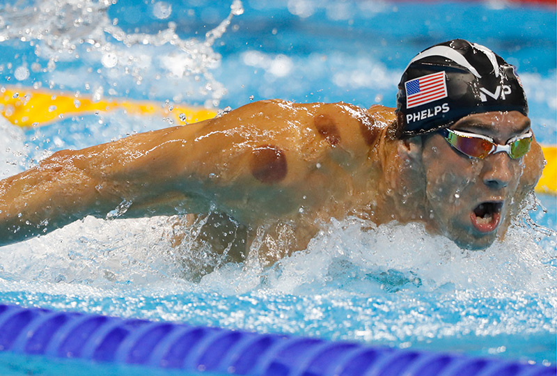 Phelps Cupping